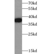 WB analysis of HepG2 cells, using KCNAB2 antibody (1/1000 dilution).