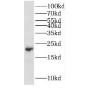 WB analysis of mouse heart tissue, using KCNE1 antibody (1/500 dilution).