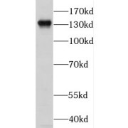 WB analysis of human brain tissue, using KCNH7 antibody (1/500 dilution).