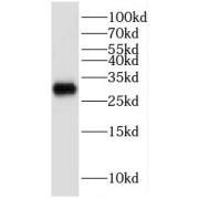 WB analysis of rat brain tissue, using KCNIP4 antibody (1/2000 dilution).