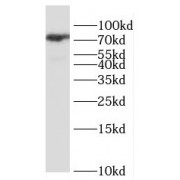WB analysis of mouse brain tissue, using KCNJ1 antibody (1/1000 dilution).