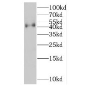 WB analysis of A431 cells, using KCNK18 antibody (1/1000 dilution).