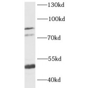 WB analysis of 293T cells, using KCNN3 antibody (1/1000 dilution).