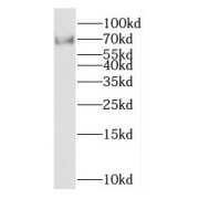 WB analysis of Y79 cells, using KCNS2 antibody (1/300 dilution).