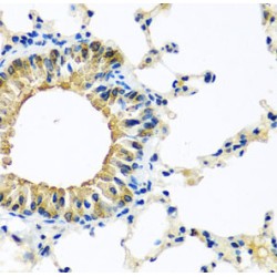 Potassium Channel Tetramerization Domain Containing 15 (KCTD15) Antibody