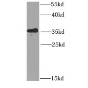 WB analysis of mouse liver tissue, using KCTD15 antibody (1/1000 dilution).