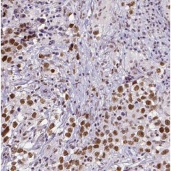 Lysine-Specific Histone Demethylase 1 (KDM1) Antibody