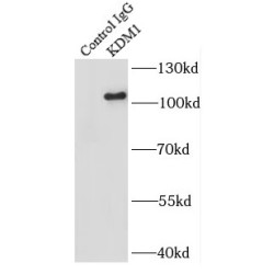 Lysine-Specific Histone Demethylase 1 (KDM1) Antibody