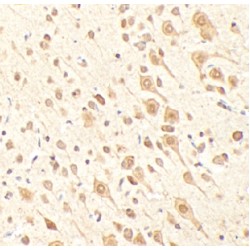 Lysine Specific Demethylase 2A (KDM2A) Antibody