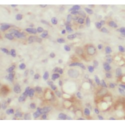 Lysine-Specific Demethylase 3A (KDM3A) Antibody