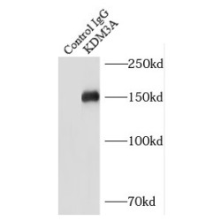 Lysine-Specific Demethylase 3A (KDM3A) Antibody