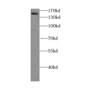 WB analysis of HeLa cells, using KDM3A, JMJD1A antibody (1/2000 dilution).