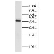 WB analysis of human stomach tissue, using KDSR antibody (1/800 dilution).