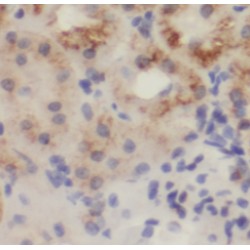Glutaminase Kidney Isoform, Mitochondrial (GLS) Antibody