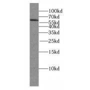WB analysis of HEK-293 cells, using GLS antibody (1/600 dilution).