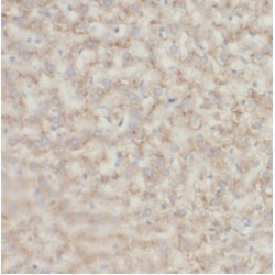 KHDC3-Like Protein (KHDC3L) Antibody