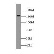 WB analysis of Jurkat cells, using KIAA0182 antibody (1/600 dilution).