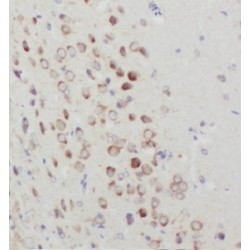 Dyslexia-Associated Protein KIAA0319-Like Protein (KIAA0319L) Antibody