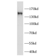 WB analysis of HeLa cells, using KIAA0319L antibody (1/500 dilution).