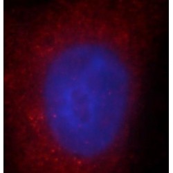 Cell Migration Inducing Hyaluronan Binding Protein / KIAA1199 (CEMIP) Antibody