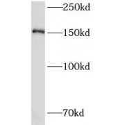 WB analysis of COLO 320 cells, using CEMIP antibody (1/500 dilution).