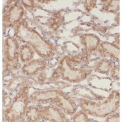 Kinesin Family Member 12 (KIF12) Antibody