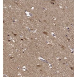 Kinesin Family Member 19 (KIF19) Antibody