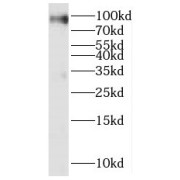 WB analysis of human brain tissue, using KIF19 antibody (1/300 dilution).
