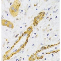 Kinesin Family Member 1B (KIF1B) Antibody