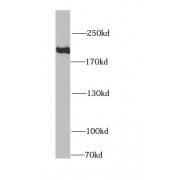 WB analysis of HeLa cells, using KIF1B antibody (1/1000 dilution).