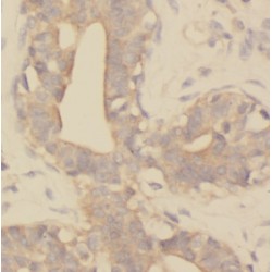 Kinesin-Like Protein KIF2A (KIF2A) Antibody