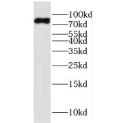 WB analysis of mouse brain tissue, using KIF2B antibody (1/1000 dilution).