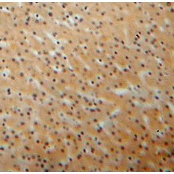 Kinesin-Like Protein KIF6 (KIF6) Antibody