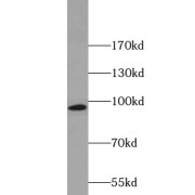WB analysis of mouse testis tissue, using KIF6 antibody (1/800 dilution).