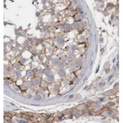 Kinesin-Associated Protein 3 (KIFAP3) Antibody