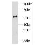 WB analysis of human liver tissue, using KIR2DL3 antibody (1/500 dilution).