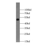 WB analysis of HeLa cells, using Kir6.1 antibody (1/500 dilution).