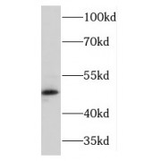 WB analysis of mouse spleen tissue, using Kir6.2 antibody (1/300 dilution).