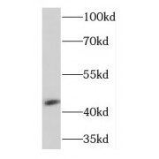 WB analysis of human brain tissue, using Kir7.1 antibody (1/300 dilution).