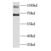 WB analysis of mouse liver tissue, using KIRREL2 antibody (1/300 dilution).