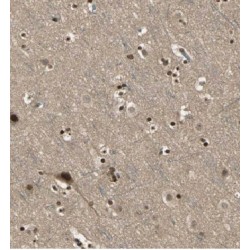 Kelch-Like Protein 15 (KLHL15) Antibody