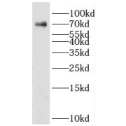 WB analysis of HeLa cells, using KLHL15 antibody (1/600 dilution).
