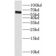 WB analysis of HepG2 cells, using KLHL18 antibody (1/600 dilution).