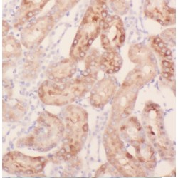 Kelch-Like Protein 20 (KLHL20) Antibody