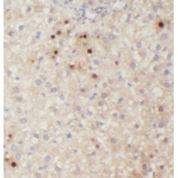 Kelch-Like Protein 3 (KLHL3) Antibody