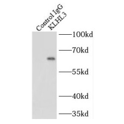 Kelch-Like Protein 3 (KLHL3) Antibody