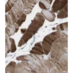 Kelch-Like Protein 31 (KLHL31) Antibody