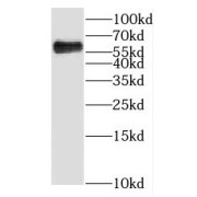 WB analysis of mouse embryo tissue, using KLHL31 antibody (1/1000 dilution).