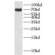 WB analysis of rat testis tissue, using KLHL34 antibody (1/600 dilution).