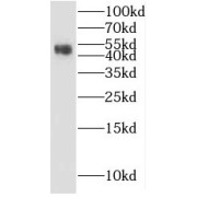 WB analysis of mouse brain tissue, using KLHL35 antibody (1/500 dilution).